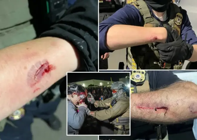 Anti-ICE agitator charged with allegedly biting officers during Delaney Hall protest