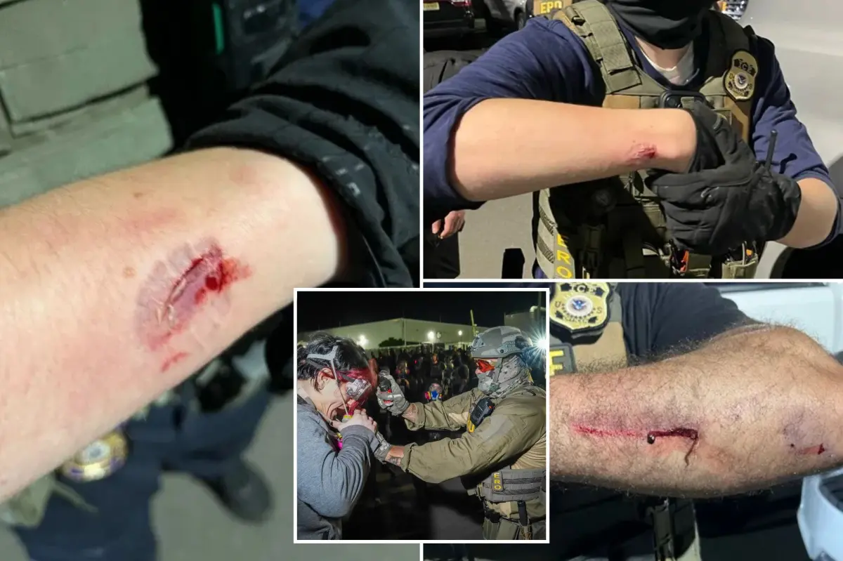 Anti-ICE agitator charged with allegedly biting officers during Delaney Hall protest