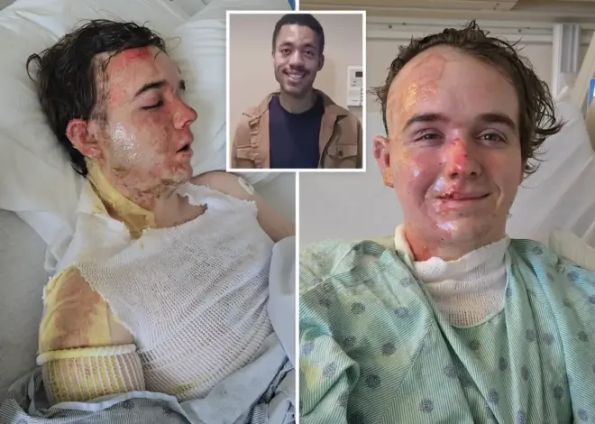 McDonald’s employee in ICU after coworker allegedly threw hot oil on him: ‘Why would he do this to me?’