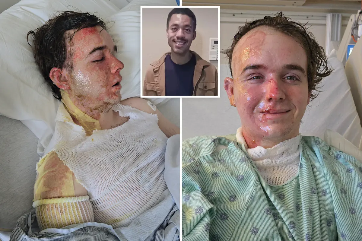 McDonald’s employee in ICU after coworker allegedly threw hot oil on him: ‘Why would he do this to me?’