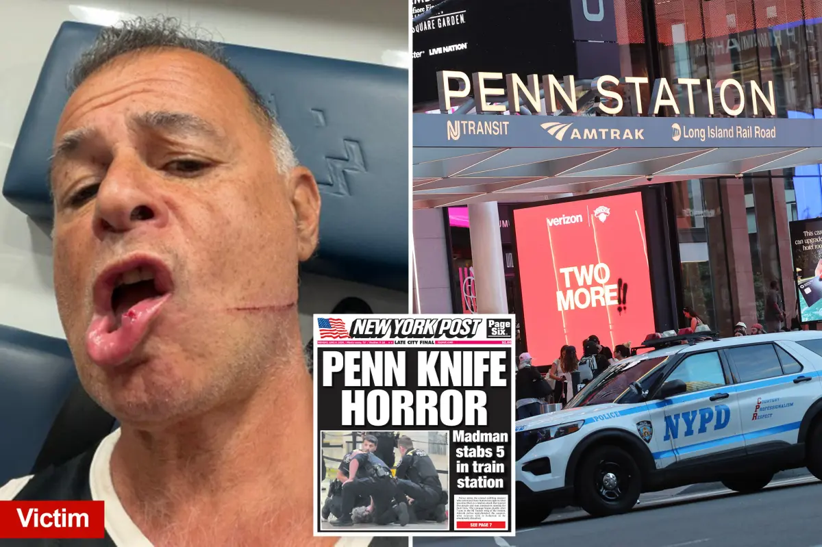 Exclusive | Penn Station slasher had ‘rage in his eyes,’ victim says while recalling NYC rampage: ‘Wanted to kill me’