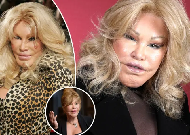 New York needs more wackos like the surgery addict Catwoman