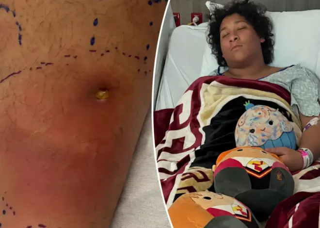 Teen ‘fighting for his life’ after contracting flesh-eating bacteria from swimming in Florida park