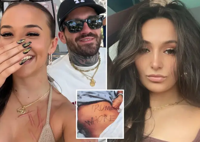 Ex-NJ GOP aide accused of staging slashing attack shows off horrific scars — and mystery man — in new snap