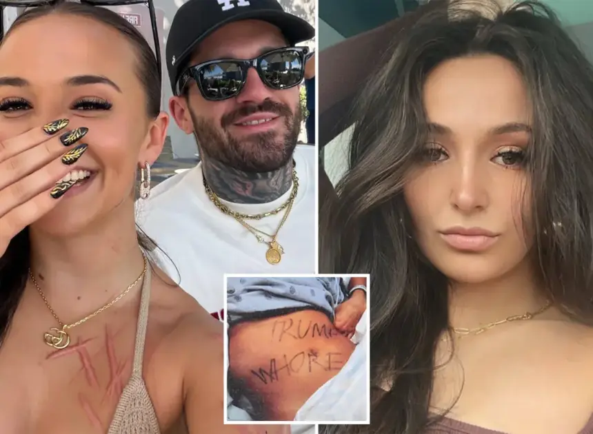 Ex-NJ GOP aide accused of staging slashing attack shows off horrific scars — and mystery man — in new snap