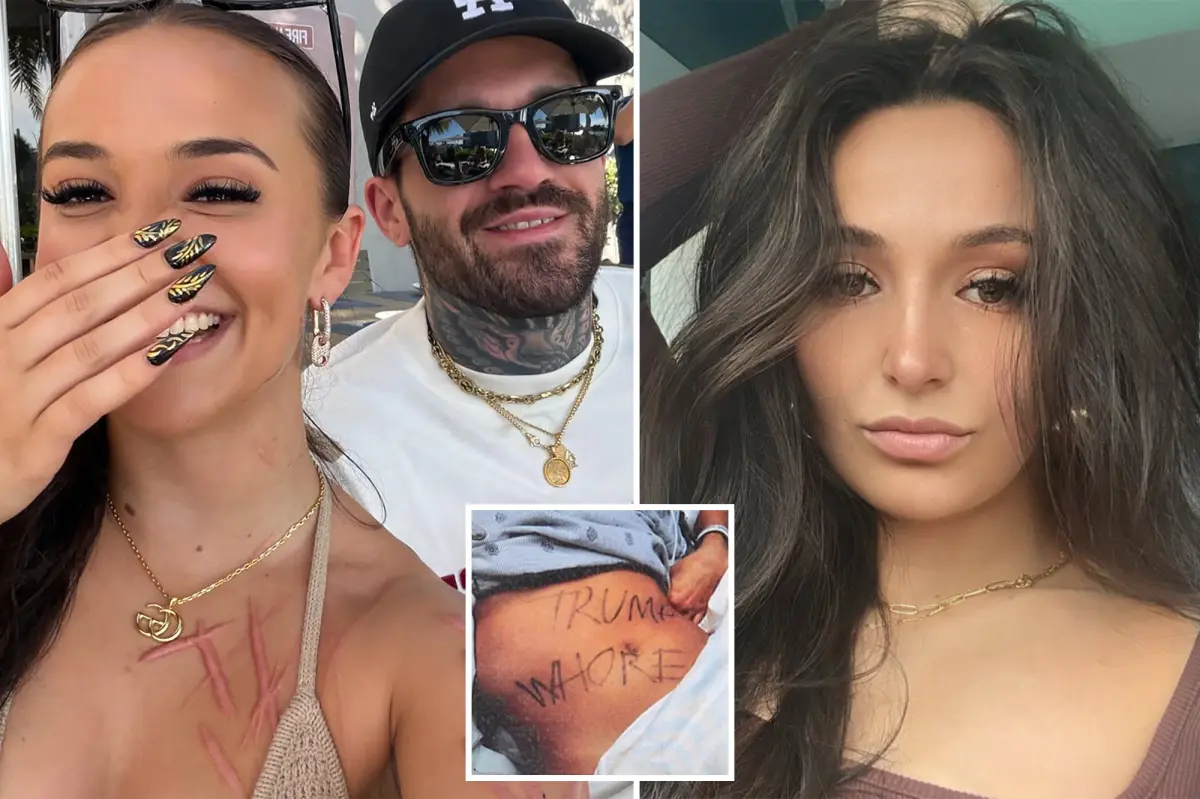 Ex-NJ GOP aide accused of staging slashing attack shows off horrific scars — and mystery man — in new snap