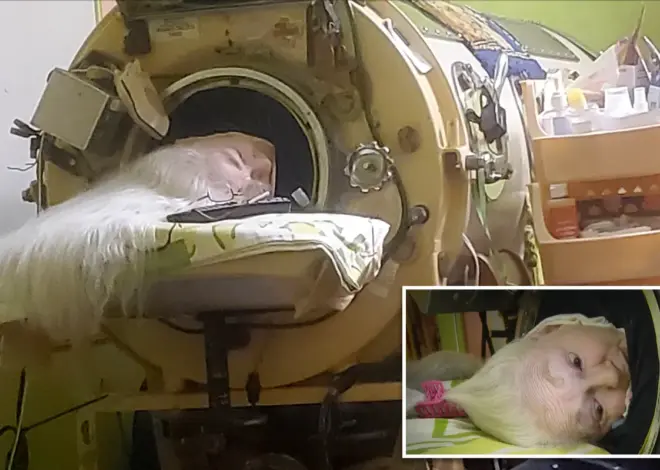 Oklahoma woman Martha Lillard, last US polio patient using iron lung, dead at 78