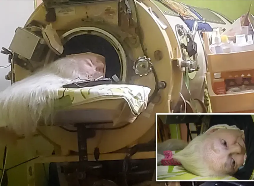 Oklahoma woman Martha Lillard, last US polio patient using iron lung, dead at 78