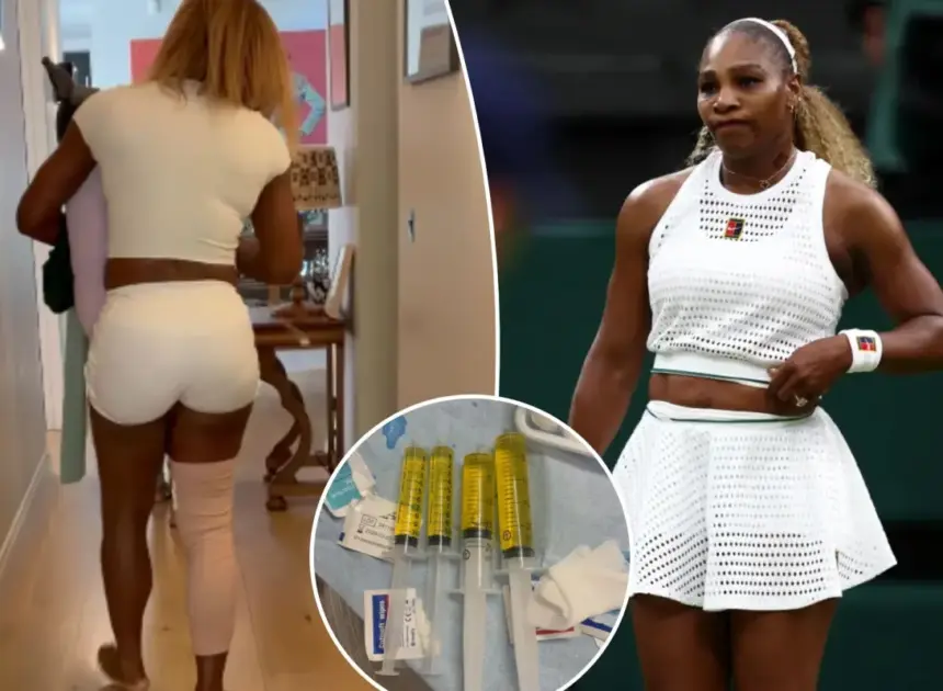 Serena Williams withdraws from Wimbledon doubles match with sister Venus because of injury: ‘Heartbroken’