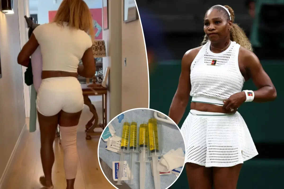 Serena Williams withdraws from Wimbledon doubles match with sister Venus because of injury: ‘Heartbroken’