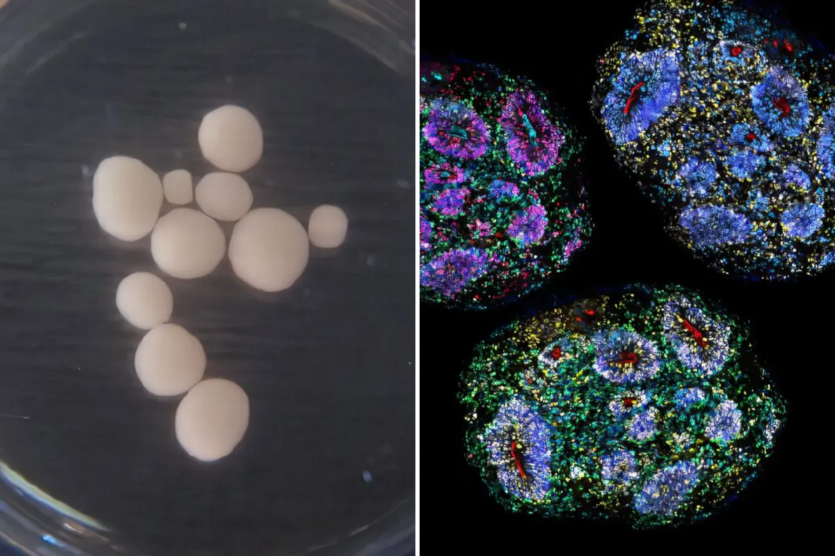 World’s oldest lab-grown human brains grow for seven years recording ‘passage of time’