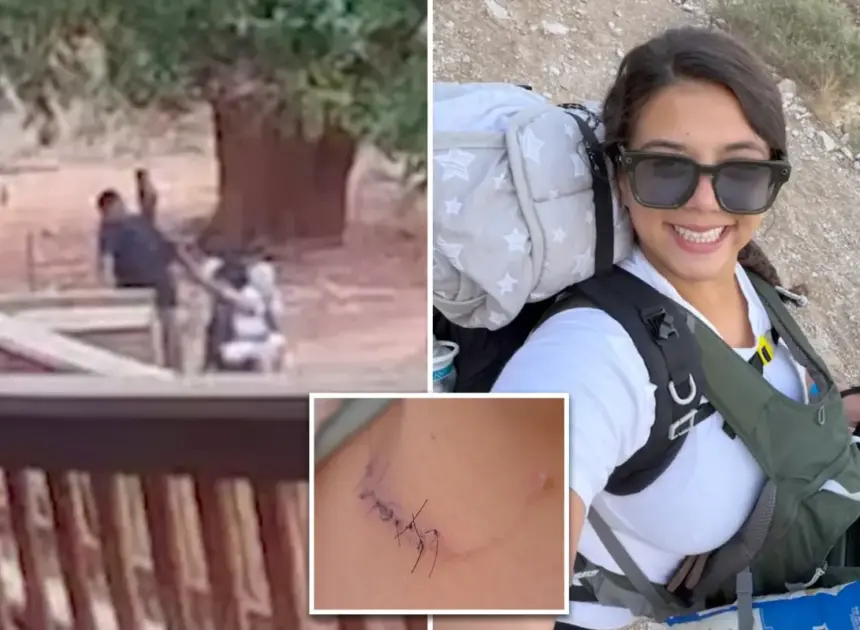 NYC mom violently slashed by ex-con during Arizona hiking trip: ‘I can’t die like this’