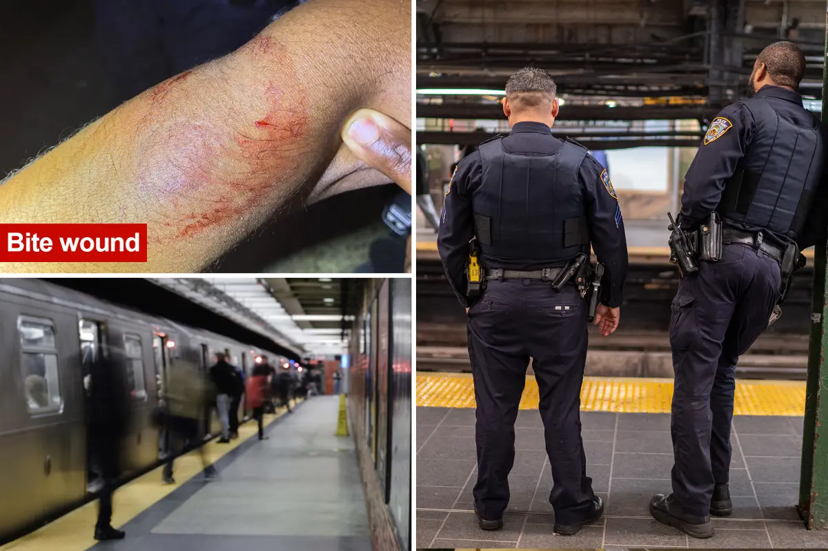 Exclusive | NYC judge fails to take bite out of crime after repeat offender chomps on cop