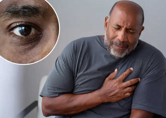 Sneaky sign of higher heart attack and stroke risk could be lurking near your eyes