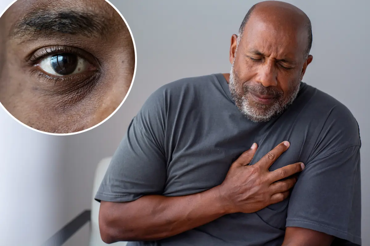Sneaky sign of higher heart attack and stroke risk could be lurking near your eyes