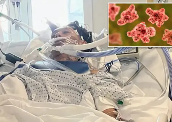 North Carolina teen dies from rare brain-eating amoeba typically linked to freshwater swimming