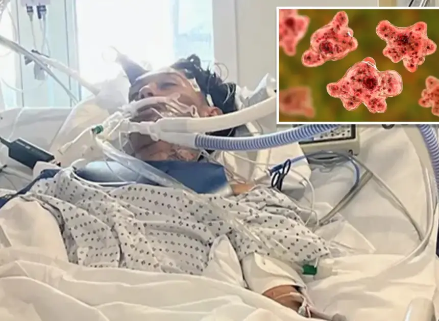 North Carolina teen dies from rare brain-eating amoeba typically linked to freshwater swimming
